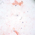 Methicillin-Resistant Staphylococcus aureus