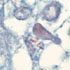 Nontuberculous Mycobacteria