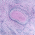 Histoplasma