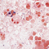Streptococcus anginosus