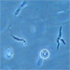 Leishmania guyanensis