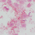 Streptococcus anginosus
