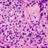 Histoplasma
