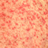 Herpesvirus 4, Human (Epstein Barr Virus)