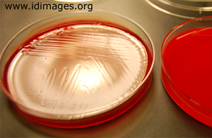 Figure 3.  Anaerobic culture on blood agar from surgical  swab, which grew a film or swarm of <i>Clostridium septicum</i>  within 24 hours.