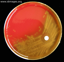 Figure 2.  <i>Streptococcus pneumoniae</i> on  blood agar plate.