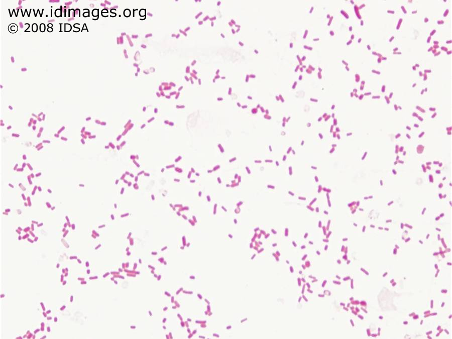 klebsiella pneumoniae gram stain