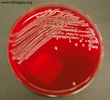 Figure 3.  <i>Salmonella typhi</i> shown on blood agar.