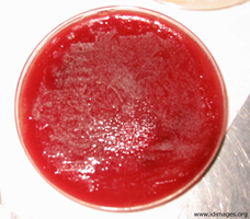 Figure 2.  <i>Malassezia furfur</i> cultured on Sabouraud dextrose agar supplemented with sterile olive oil.