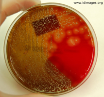 Figure 2. <i>Arcanobacterium haemolyticum</i> in culture.