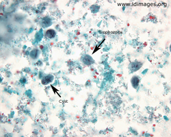 Figure 1.  Giardia trophozoites and cysts, trichrome stain, under oil (100x magnification).