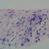 Mycobacterium tuberculosis