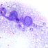 Leishmania braziliensis