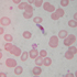 Plasmodium falciparum