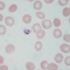 Plasmodium falciparum