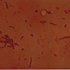 Bacillus anthracis