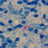 Mycobacterium leprae