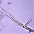 Pythium