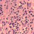 Fasciola hepatica