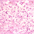 Cryptococcus neoformans