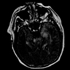 Encephalitis Virus, Eastern Equine