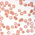 Plasmodium falciparum