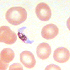 Plasmodium falciparum