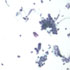 Klebsiella pneumoniae