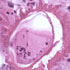 Schistosoma mansoni