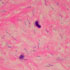 Clostridium septicum