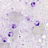 Leishmania donovani