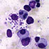 Leishmania donovani