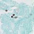 Cryptococcus neoformans