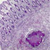 Actinomyces