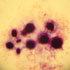 Cryptococcus neoformans