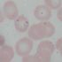 Plasmodium falciparum