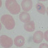 Plasmodium falciparum