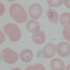 Plasmodium falciparum