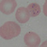 Plasmodium falciparum