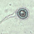 Aspergillus fumigatus