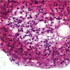 Mycobacterium tuberculosis