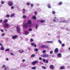 Mycobacterium tuberculosis