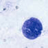 Toxoplasma