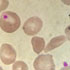 Plasmodium falciparum