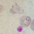 Plasmodium falciparum