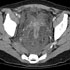 Clostridium septicum