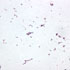 Listeria monocytogenes