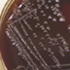 Corynebacterium diphtheriae