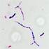 Nocardia