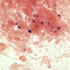 Staphylococcus aureus